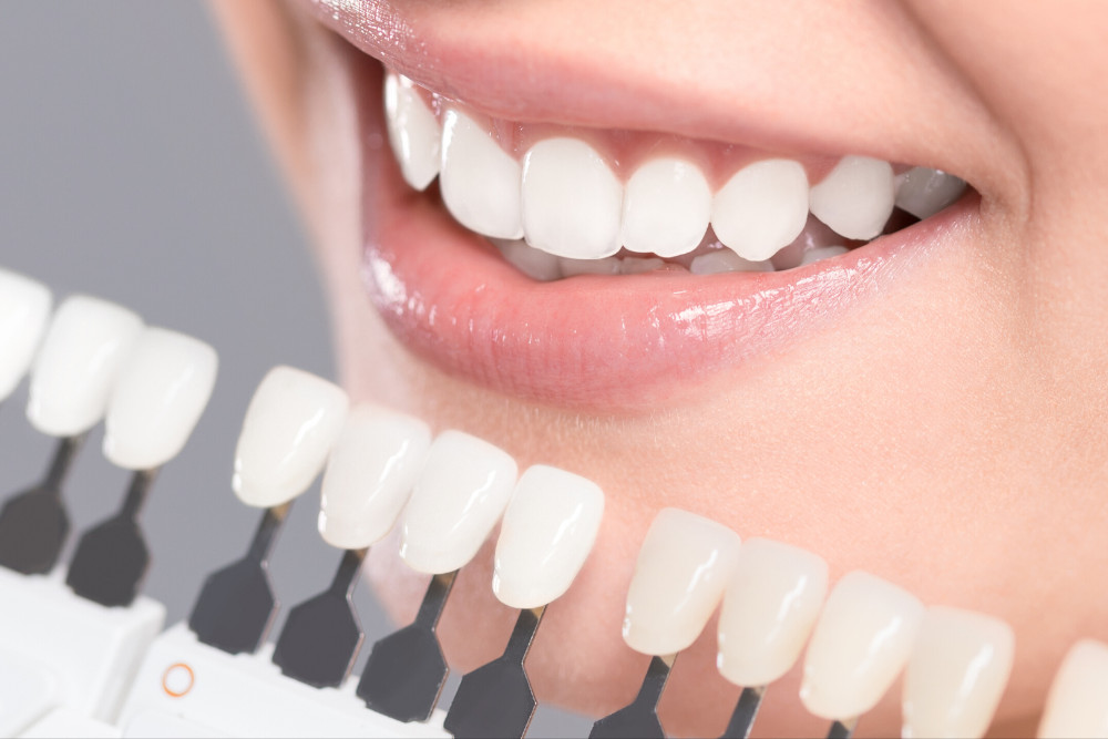 Whitening